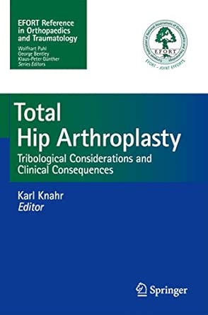 Total Hip Arthroplasty: Tribological Considerations and Clinical Consequences 2013th Edition-Wow! eBook