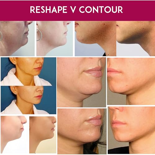 Anacis Advanced Neck Under Chin Mask Works for V-line Neck Chin Jawline - Fine Lines - Neck Wrinkles - Sagging Skin - For Women and Men. (5 Double Masks) - Thumbnail 6