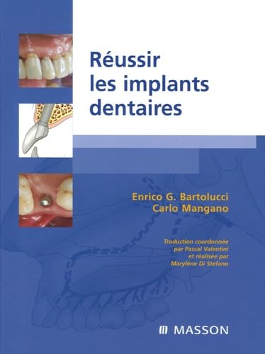 Réussir les implants dentaires