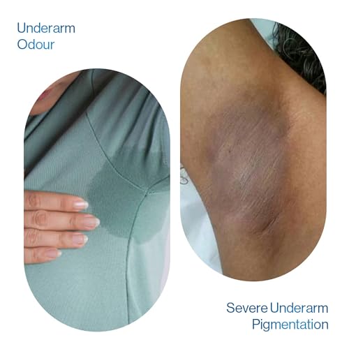 Image of Be Bodywise Advanced Pigmentation Kit | With 6% AHA BHA Flora Underarm Roll-On (50ml) & Pigmentation Repair Cream (100g) | Reduces Body Odor, Fades Pigmentation & Corrects Uneven Skin Tone