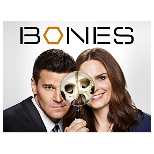 Bones