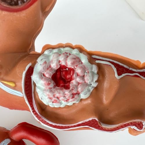 Modèle du système digestif pour illustrer vos consultations médicales - 5