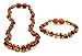 primoyo Set Bernsteinkette & Armband/Fußkettchen (Cognac) Baltischer Bernstein – 100% Handarbeit – EIN tolles Geschenk