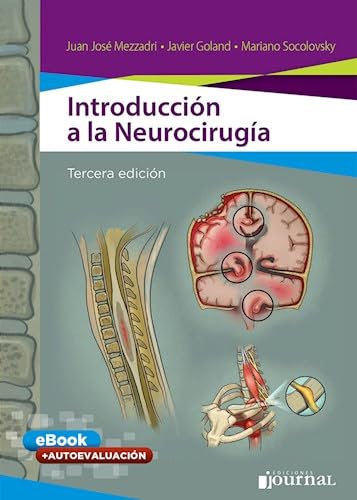 Introducción a la Neurocirug¡a (Libro E-Book)
