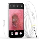 ScopeAround Otoscope with Light