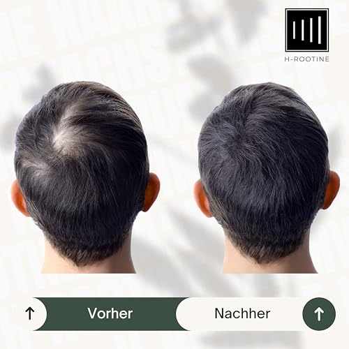 Foto von H-ROOTINE Coffein-Shampoo gegen Haarausfall* für Männer (200ml) • Anti-Haarausfall* Shampoo mit Coffein, Rosmarin & Ginseng • Fördert Haarwachstum & pflegt die Kopfhaut