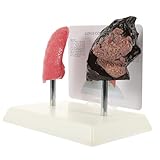 Cabilock Anatomisches Modell Der Menschlichen Lunge Pathologisches Raucherlunge Vergleichsmodell Aus Langlebigem Umweltfreundlichem Material Für Schulunterricht Und Gesundheitsbildung