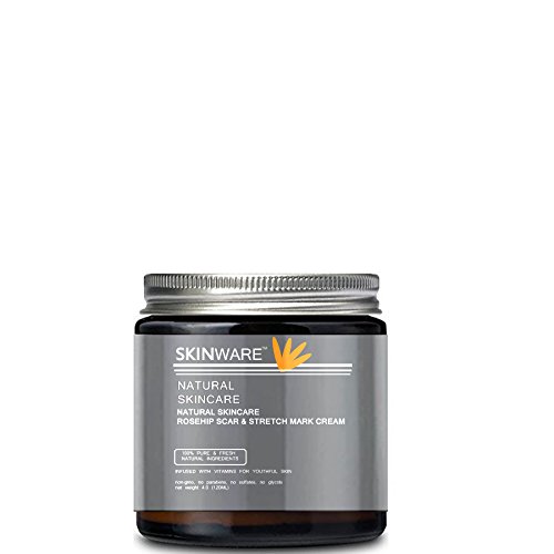 Rosehip Stretch Mark Prevention Cream (Pregnancy, Mothers, Belly Rub)