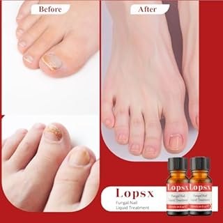 Trattamento per Micosi Unghie Piede Lopsx – Antimicotico Unghie Piedi Formula Innovativa e Delicata, Protezione Duratura, Applicazione Facile con Pennello Sottile, 10ml