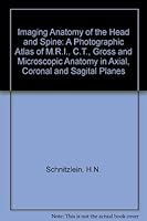 Imaging Anatomy of the Head and Spine: A Photographic Atlas of M.R.I., C.T., Gross and Microscopic Anatomy in Axial, Coronal and Sagital Planes 0806718811 Book Cover