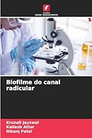 Biofilme do canal radicular (Portuguese Edition) 6200819483 Book Cover