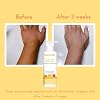 WishCare Sunscreen Body Lotion with SPF 50 PA+++ Broad Spectrum UVA & UVB Protection, No White Cast, Enriched with Carrot Seed & Raspberry - Body Sunscreen Lotion 200ml (Indian Version)