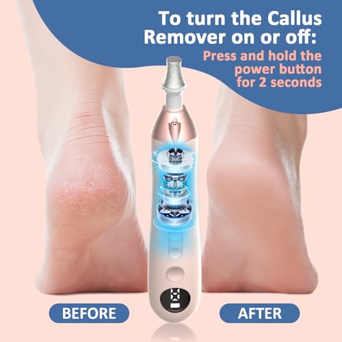 Image of Mfish Electric Callus Remover for Feet, Rechargeable Foot File with Digital Display, 9 Speeds & 8 Grinding Heads, Professional Pedicure Tool for Thick Calluses, Cracked Heels & Hard Skin Pink