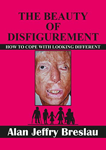 The Beauty of Disfigurement: How to Cope With Looking Different (English Edition)