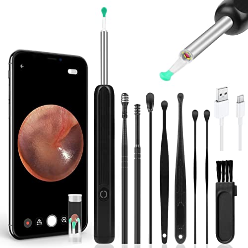 ACWOO Otoskop endoskop, Otoskop cyfrowy, endoskop do uszu, aparat uszy 1296P WIFI oczyszczacz uszu z 6 diodami LED, 4,5 mm HD endoskop ucha, zestaw do czyszczenia uszu dla iOS i Androida (czarny)