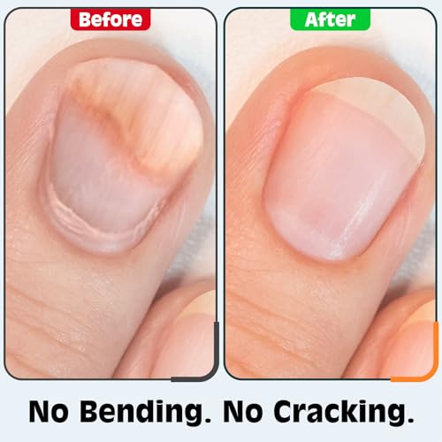 Image of Nail Clippers Set, Fingernail and Toenail Clipper Cutters Kit | Ultra Sharp All-IN-ONE Kit: 15% Thicker Premium Sturdy Podiatrist Toe Nail Care Tools. Perfect Grooming Gifts with Case
