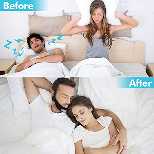 Chin Straps Devicesanti Snoring Devices Anti Snoring Chin Strap For Men Women,2023 Upgrade Anti Snoring Devices,Chin Straps Sleep Aids For Snoring Mouth Breather Better Sleep #TOP2