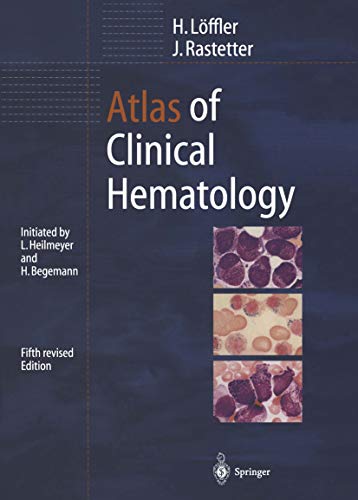 Atlas of Clinical Hematology (English Edition)