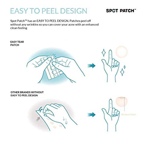 Image of SPOT PATCH BHA Ultra Slim (102 Dots | 2 Sizes) | Acne Pimple Patches Hydrocolloid for Blemish | Made in Korea | Sterilized