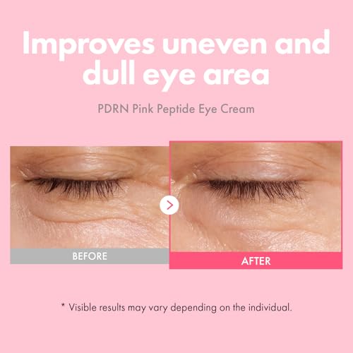 Image of TOSOWOONG PDRN Pink Peptide Eye Cream for Fine Lines & Dark Circles