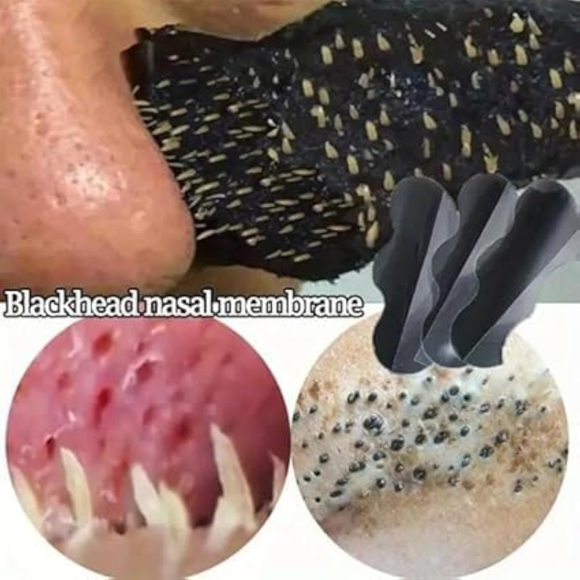 Nose Strips for Blackhead Removal