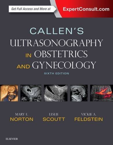 Image of Callen