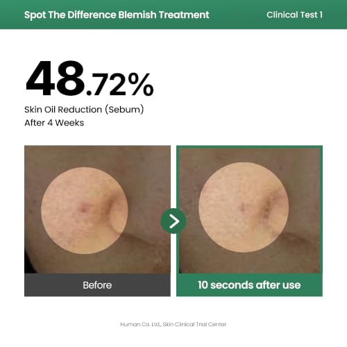 Image of AXIS-Y Spot The Difference Blemish Spot Treatment - 4-Terpineol 2% Niacinamide AHA BHA Soothes Breakouts & Skin Barrier Repair - Vegan Korean Skin Care Face Serum (0.50 fl. oz.)