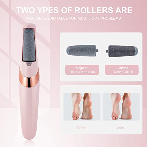 Aoowu Electric Foot File, Usb Rechargeable Feet Callus Remover With 2 Speed Of Replacement Rollers & Led Lights, Professional Hard Skin Remover Foot Care Tools For Cracked Heels Calluses & Dead Skin #TOP1