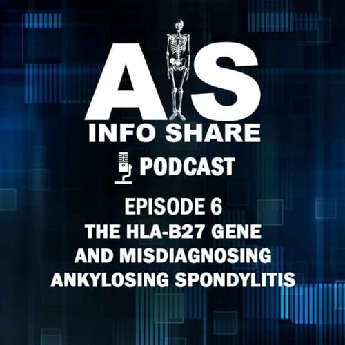 THE HLA-B27 GENE AND MISDIAGNOSING ANKYLOSING SPONDYLITIS Titelbild