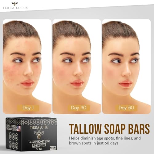 Organic Tallow Soap with Organic Castor Oil & Raw Honey - Relief for Dark Spots, Acne Marks, Hydrating & Nourishing - 3 Pack (Unscented) - Image 5