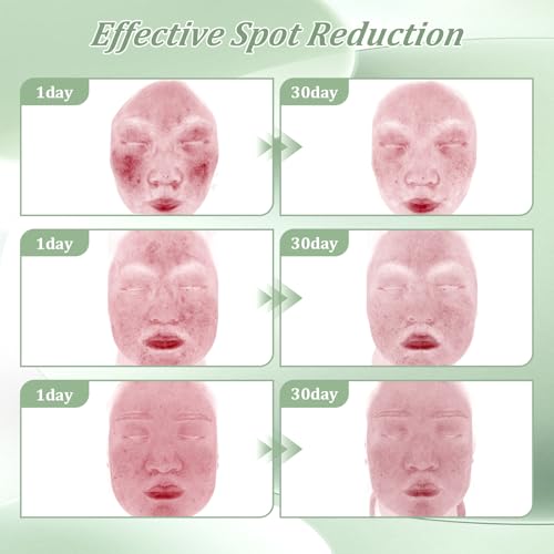 Bablabear 2% Salicylic Acid Acne Treatment Cream for Face Back/Butt/Body,Spot Treatment for Pimples,Face Blemishes,Blackheads,Oil Control,Ingredients are Natural,Suitable for Teenagers/Women/Men（30g）