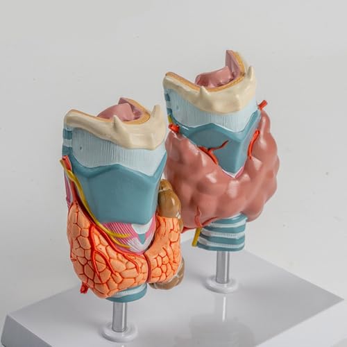 Modèle de thyroïde pathologique pour simulation de démonstration clinique