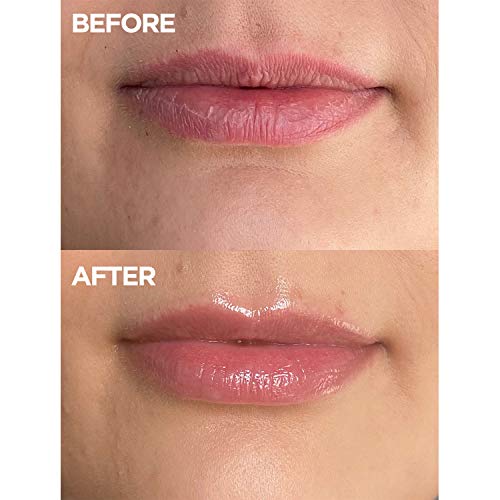 Lanolips 101 Ointment Strawberry - Image 5