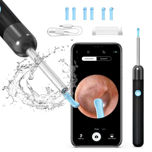 Endoscope oreille le top 10 de juin 2022 ⇒ Les Meilleurs .info
