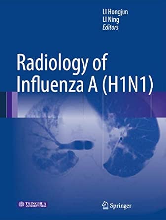 Radiology of Influenza A 2013th Edition book cover
