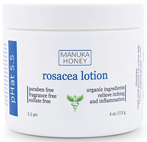 Rosacea Cream - with Manuka Honey, Aloe Vera & Coconut Oil Extract - Redness, Inflammation, Acne, Rosacea Relief - Paraben & Sulfate Free (4oz)