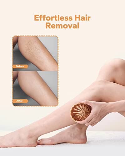 Meto Crystal Hair Eraser For Women And Men, Upgraded Hair Eraser Crystal Hair Remover, Magic Painless Exfoliation Hair Removal Tool For Arms Legs Back, Reusable & Washable Epilator For Women (Gold) #TOP1