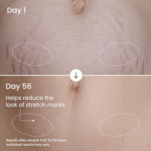 MAËLYS B-FLAT Belly Firming Cream for Women - Skin Tightening & Moisturizing Treatment with Shea Butter & Bentonite Clay - Smooths Look of Stretch Marks - Postpartum Body Care (3.4 Fl Oz) - Image 5