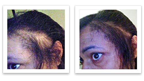 Hair Powder For Thinning Hair. Makes Thin Hair Look 10X Fuller, Covers Bald Spot Instantly. All-Natural Hair Building Fiber. Trial Size (10-Day Supply). Black - Thumbnail 6