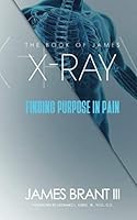 The Book of James : X-Ray: Find Purpose in Pain 0999538462 Book Cover