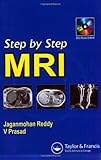 Step By Step MRI
