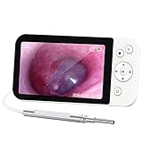 ▶Pantalla IPS portátil de 5": No se requieren aplicaciones ni teléfonos móviles. Cámara de eliminación de cerumen segura para el hogar con pantalla IPS a todo color de 5". La observación clara en tiempo real es más fácil y conveniente. No se preocupe por estropear su teléfono descargando aplicaciones.