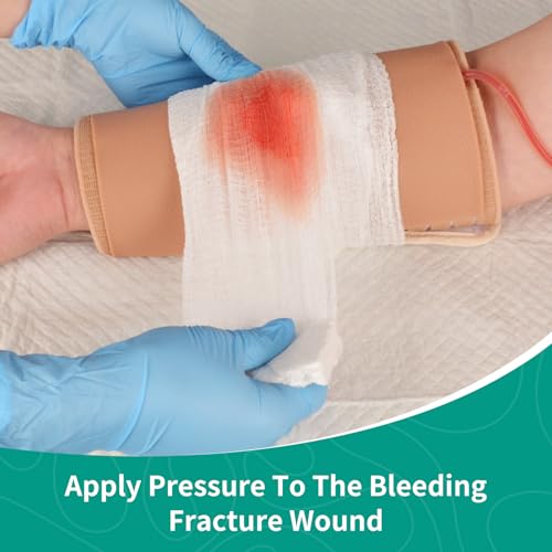 Modèle d'éducation médicale pour fracture ouverte et pansement d'urgence