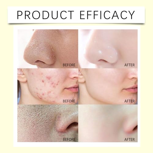 Teint uniforme nettoyant profond gommage visage vitamine C