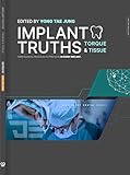 implantes dentales gratis  Implant Truths: Torque & Tissue (English Edition)