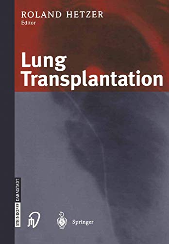 Lung Transplantation view 2