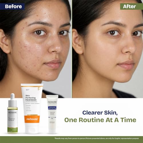 Image of Proskire Anti Acne Skincare Combo Kit with 2% Salicylic Acid Serum, Oil Control Face Wash & Acne Spot Gel for Pimples, Oily & Acne Prone Skin
