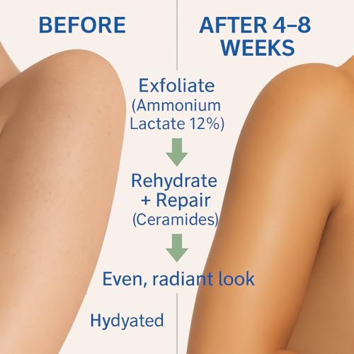 Image of Lacderm Moisturize Lacsoft Lotion (150Ml)