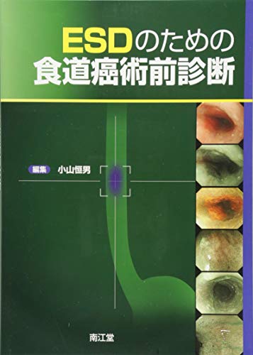 無料電子書籍 アプリ ESDのための食道癌術前診断 バイ