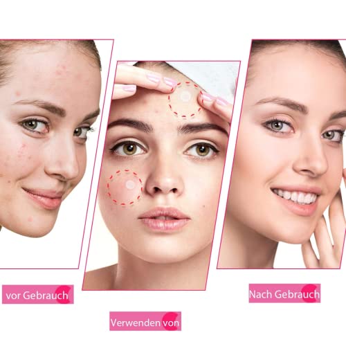 Pimple Patch Jolvka Akne Pickel Patch 120 Stück